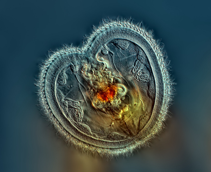 De microscopische wereld – photomicroscopy