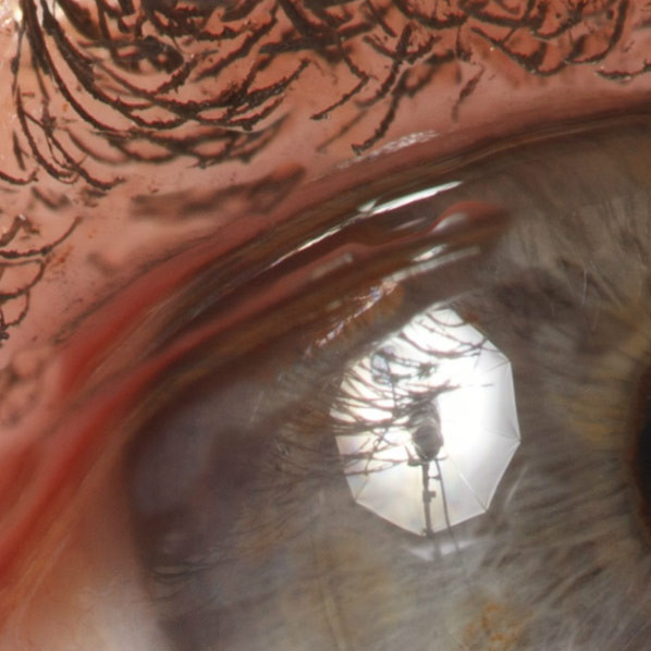 Pia - Oog