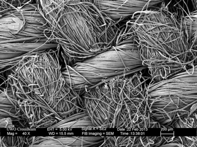 Fascinerende electronenmicroscoop foto's