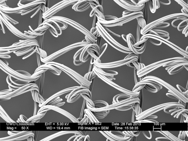Fascinerende electronenmicroscoop foto's