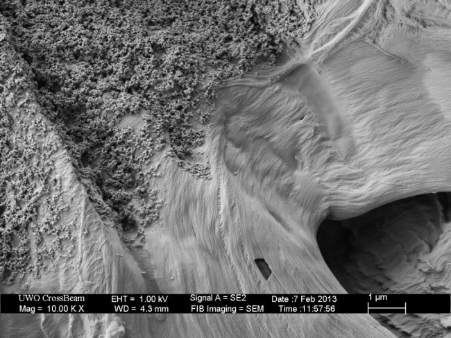 Fascinerende electronenmicroscoop foto's